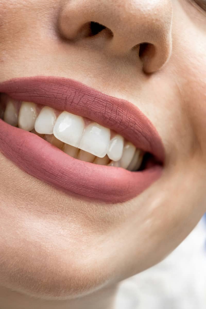 Stunning close-up of perfect white teeth